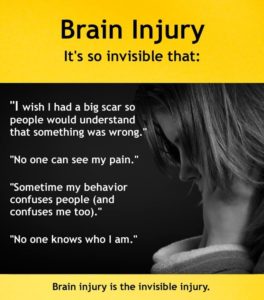 Brain injury so invisible that 264x300