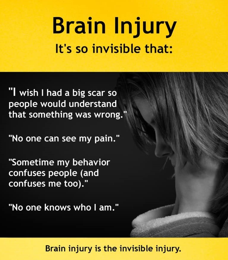 Brain injury so invisible that